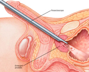 Pedro Heniruqe Moreira Urologista